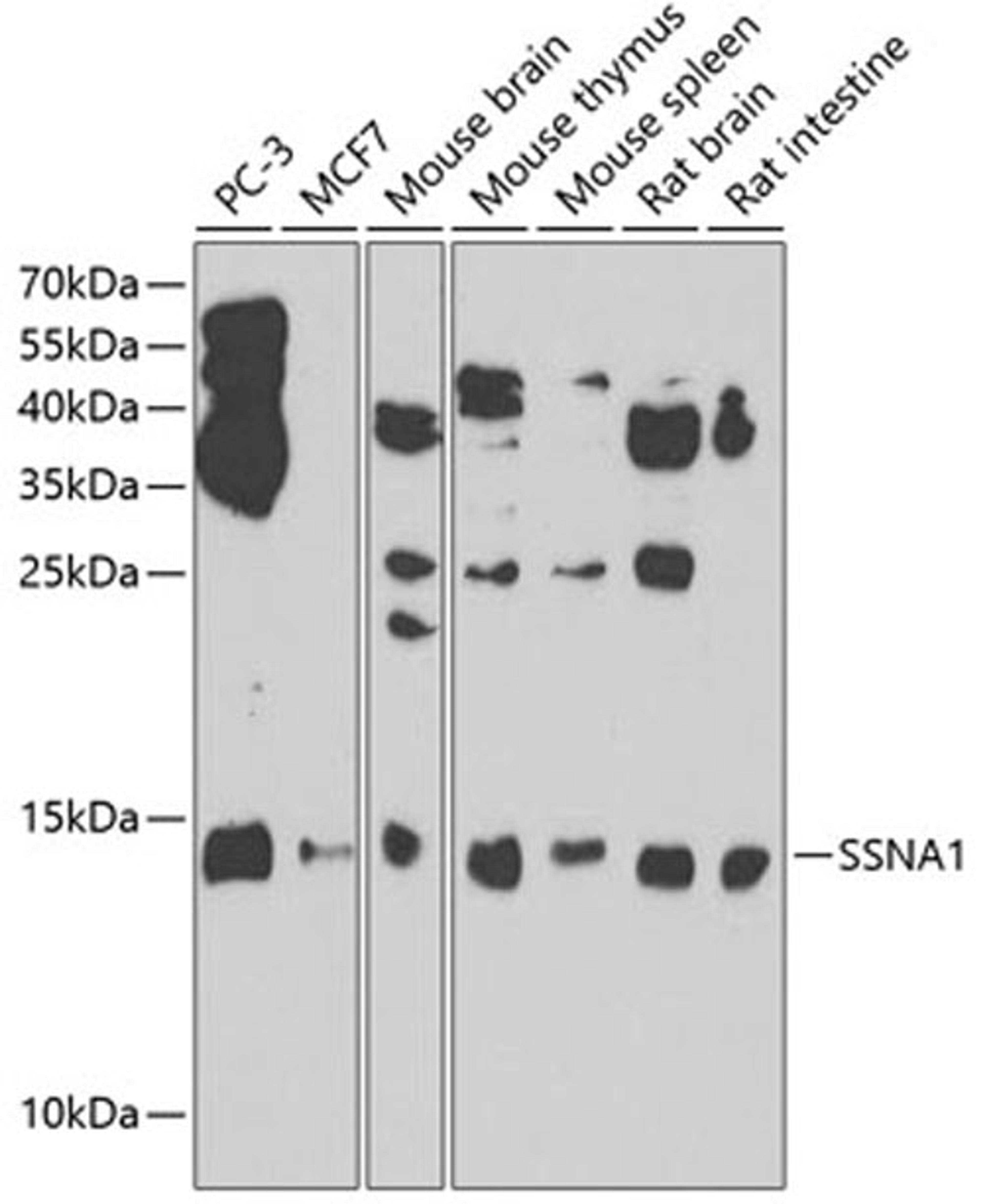 Western blot - SSNA1 antibody (A7944)