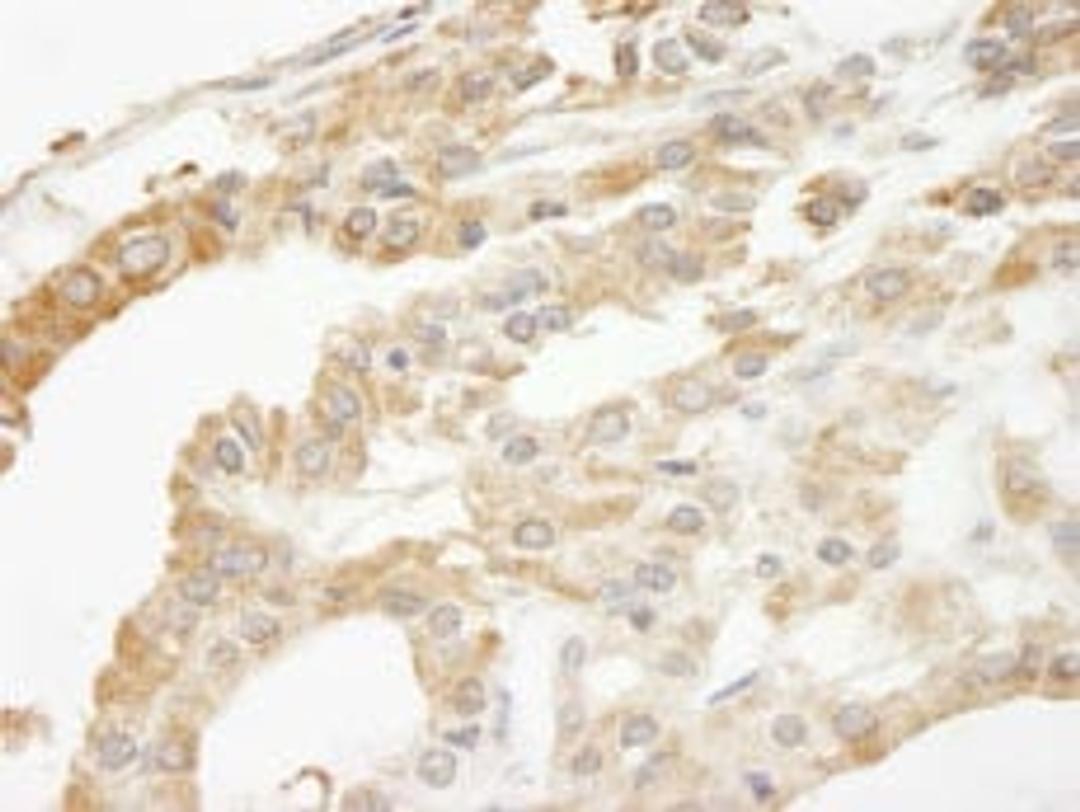 Detection of human ABCF2 by immunohistochemistry.