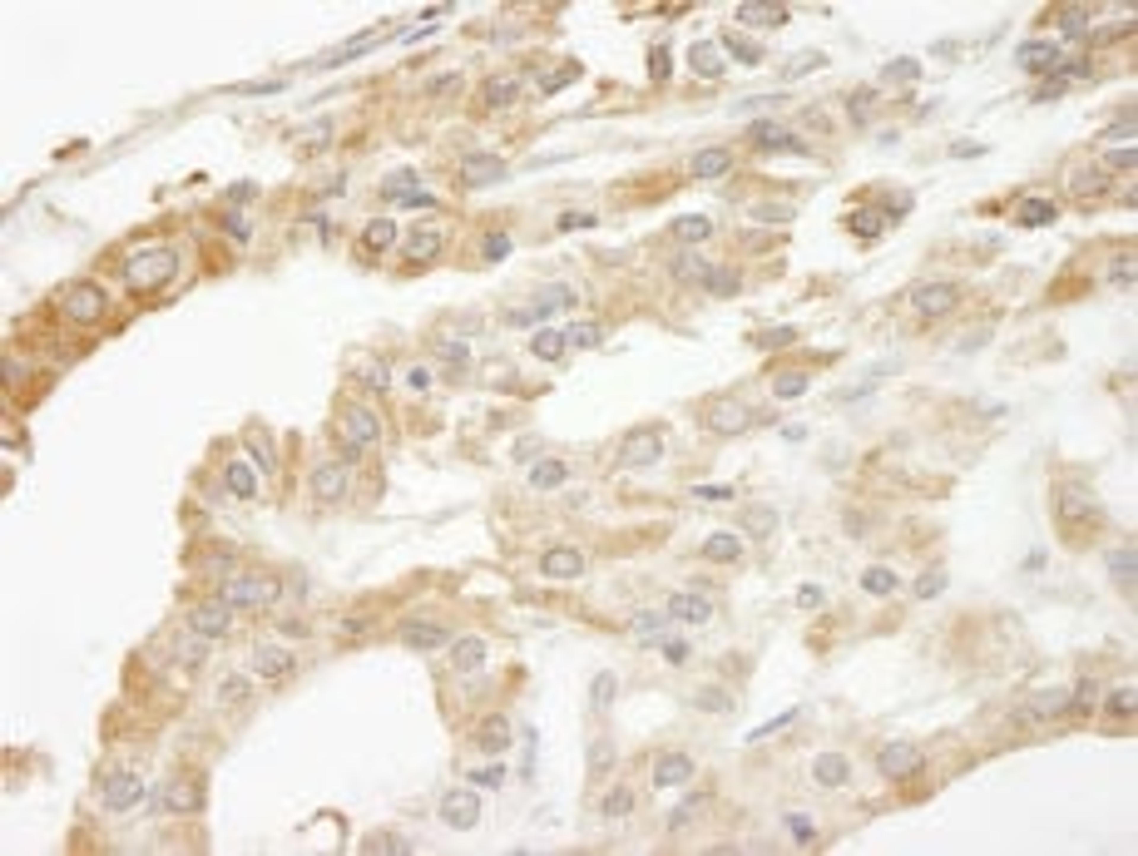 Detection of human ABCF2 by immunohistochemistry.