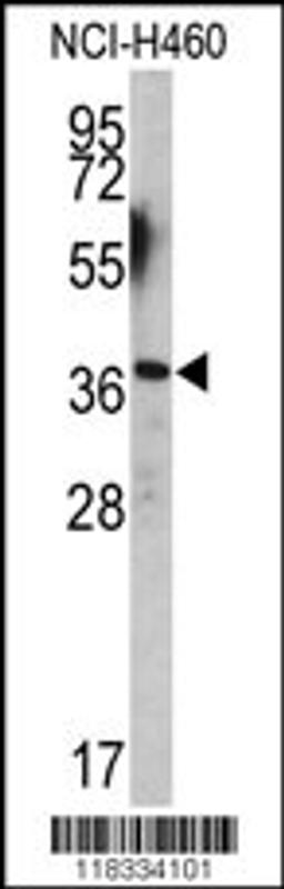 Western blot analysis of EN2 antibody (C-term-2) in NCI-H460 cell line lysates (35ug/lane)