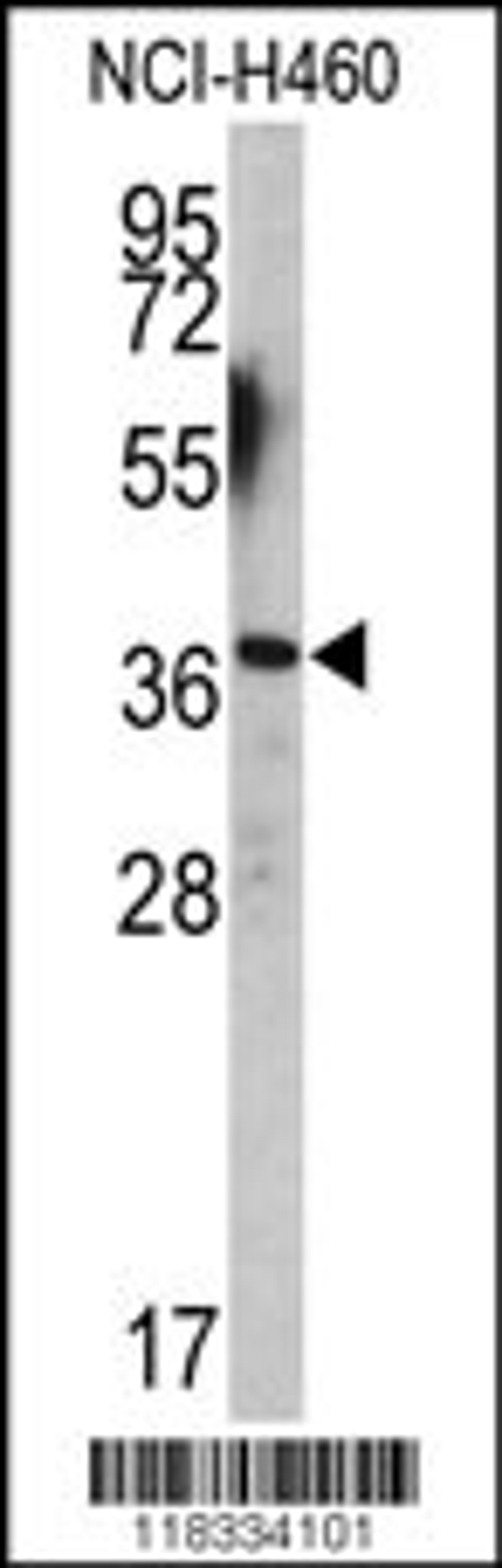 Western blot analysis of EN2 antibody (C-term-2) in NCI-H460 cell line lysates (35ug/lane)