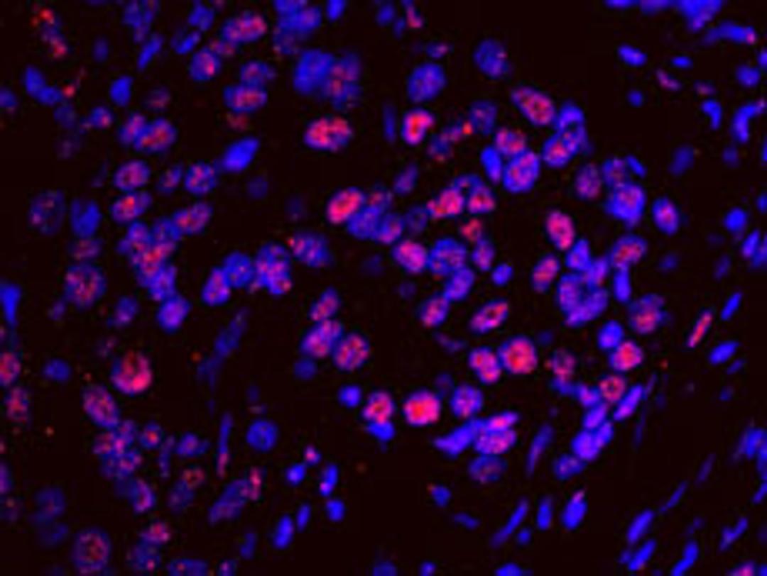 Detection of human SF3a120/SAP114 by IHC-IF.