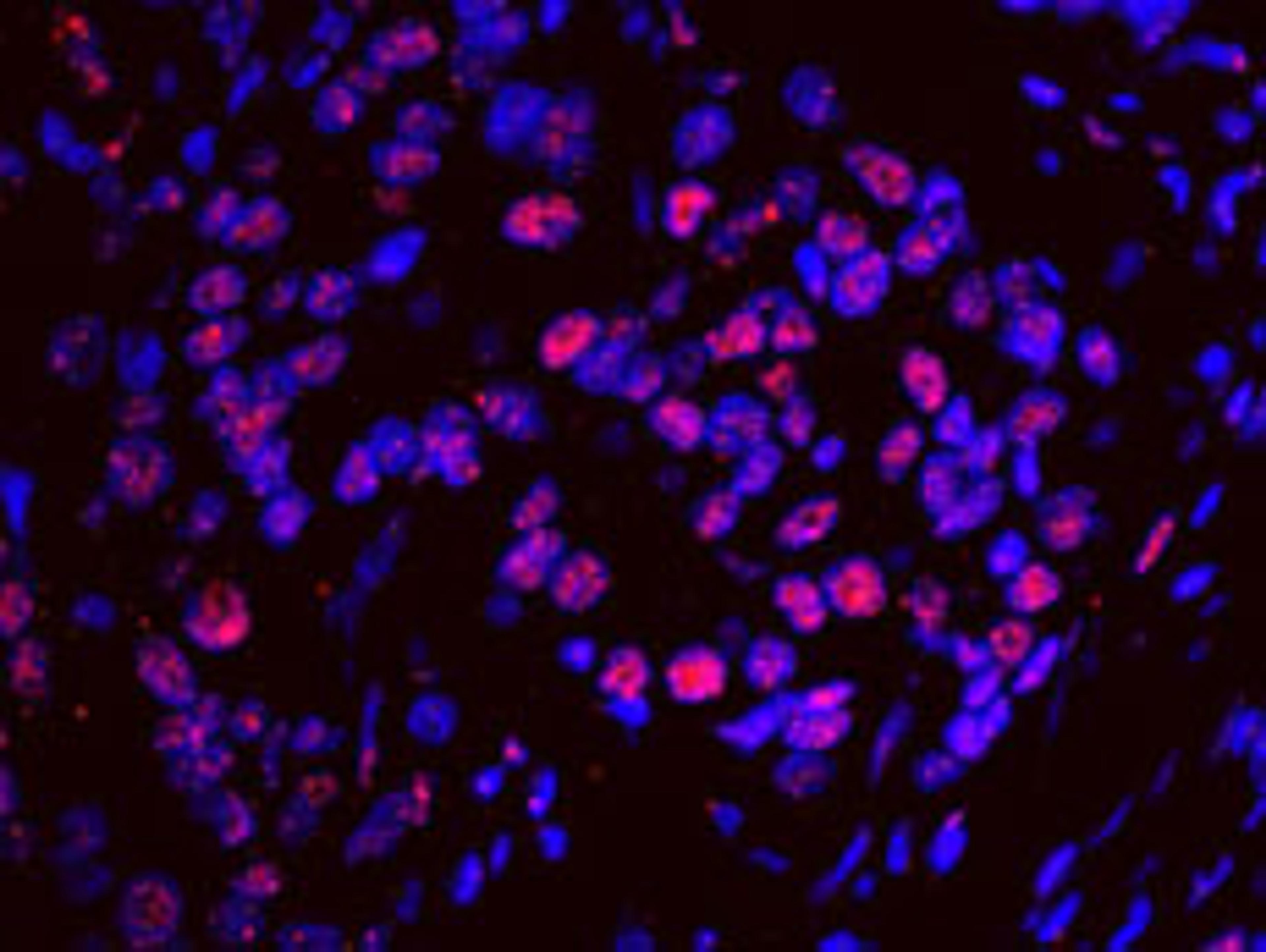 Detection of human SF3a120/SAP114 by IHC-IF.