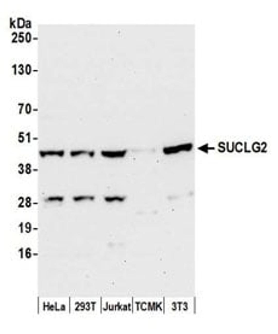 Detection of human and mouse SUCLG2 by western blot.