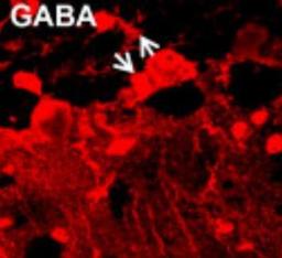 Immunohistochemistry-Frozen: GABA Antibody [NB120-17413] - IHC of adult mouse brain with NB120-17413 showing the presence of GABA in glial cells in cerebellar cortex.