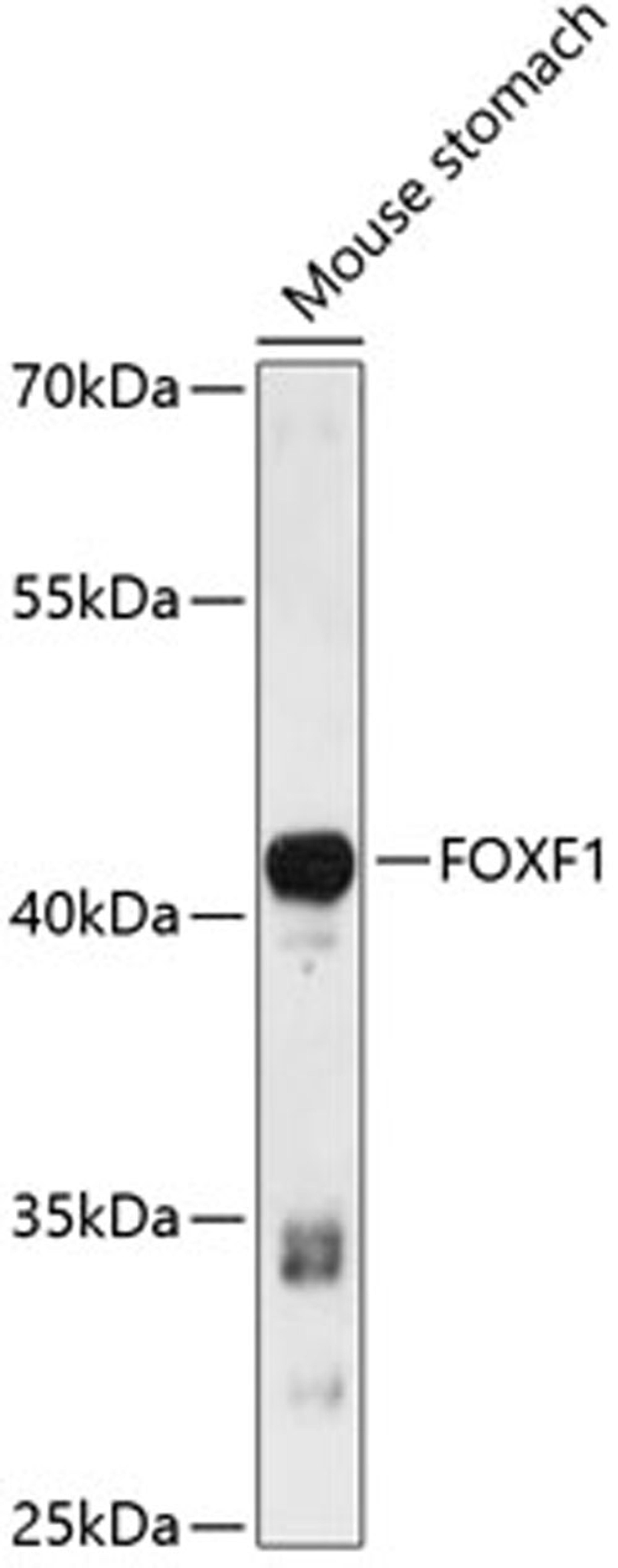 Western blot - FOXF1 antibody (A13017)