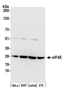 Detection of human and mouse eIF4E by western blot.