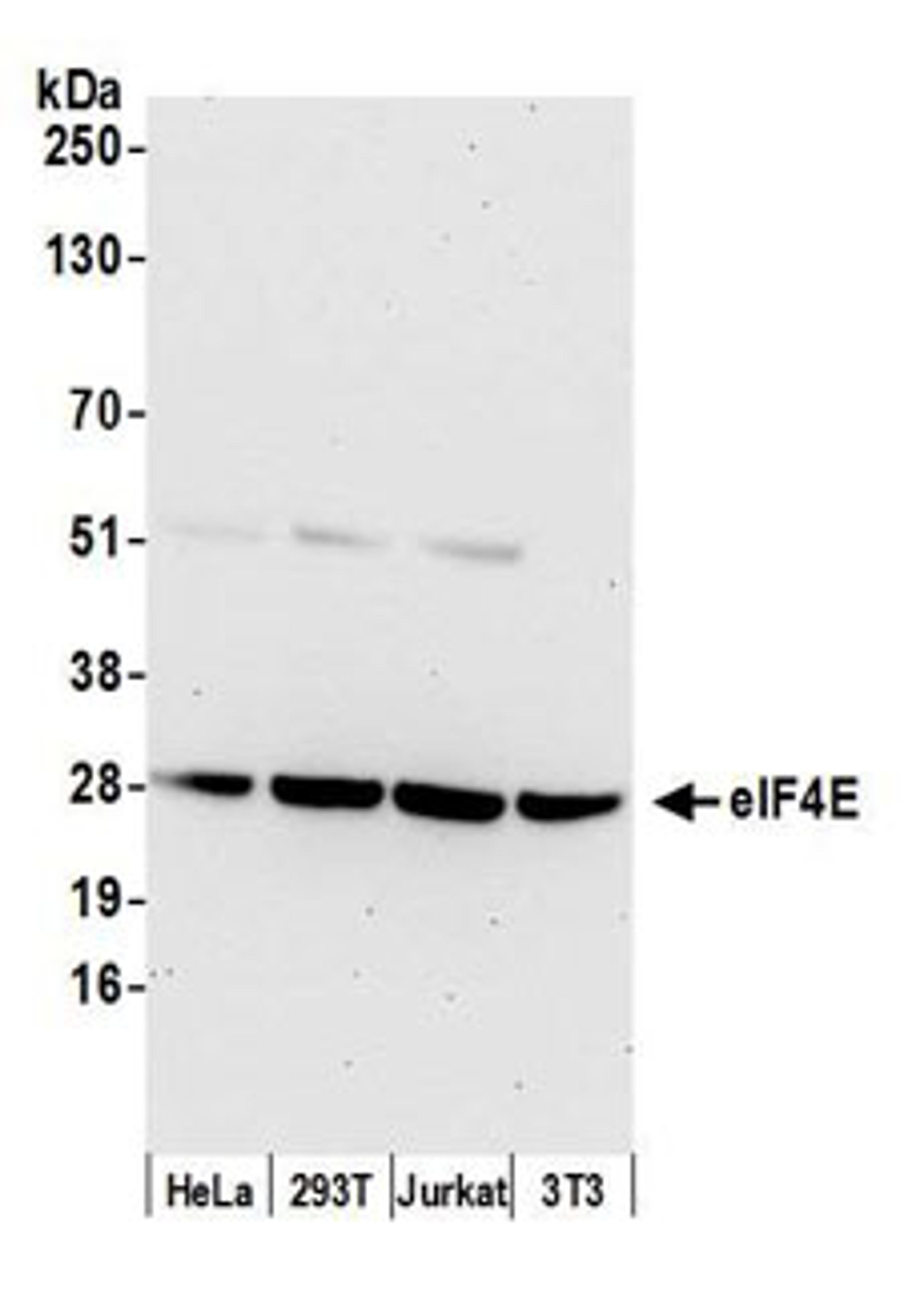 Detection of human and mouse eIF4E by western blot.