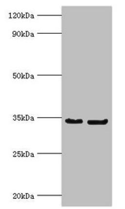 Western blot. All lanes: P antibody at 2µg/ml. Lane 1: Rabies virus Phosphoprotein protein at 1µg. Lane 2: Rabies virus Phosphoprotein protein at 0.1µg. Secondary. Goat polyclonal to rabbit IgG at 1/10000 dilution. Predicted band size: 34, 32, 28, 26, 25 kDa. Observed band size: 34 kDa