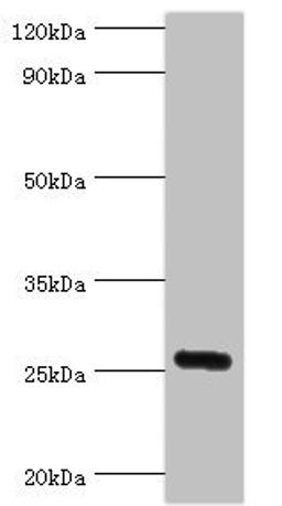 Western blot. All lanes: IL27 antibody at 2ug/ml + Mouse liver tissue. Secondary. Goat polyclonal to rabbit IgG at 1/10000 dilution. Predicted band size: 27 kDa. Observed band size: 27 kDa. 