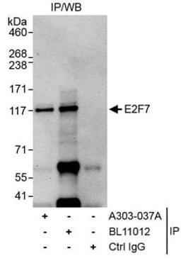 Detection of human E2F7 by western blot of immunoprecipitates.