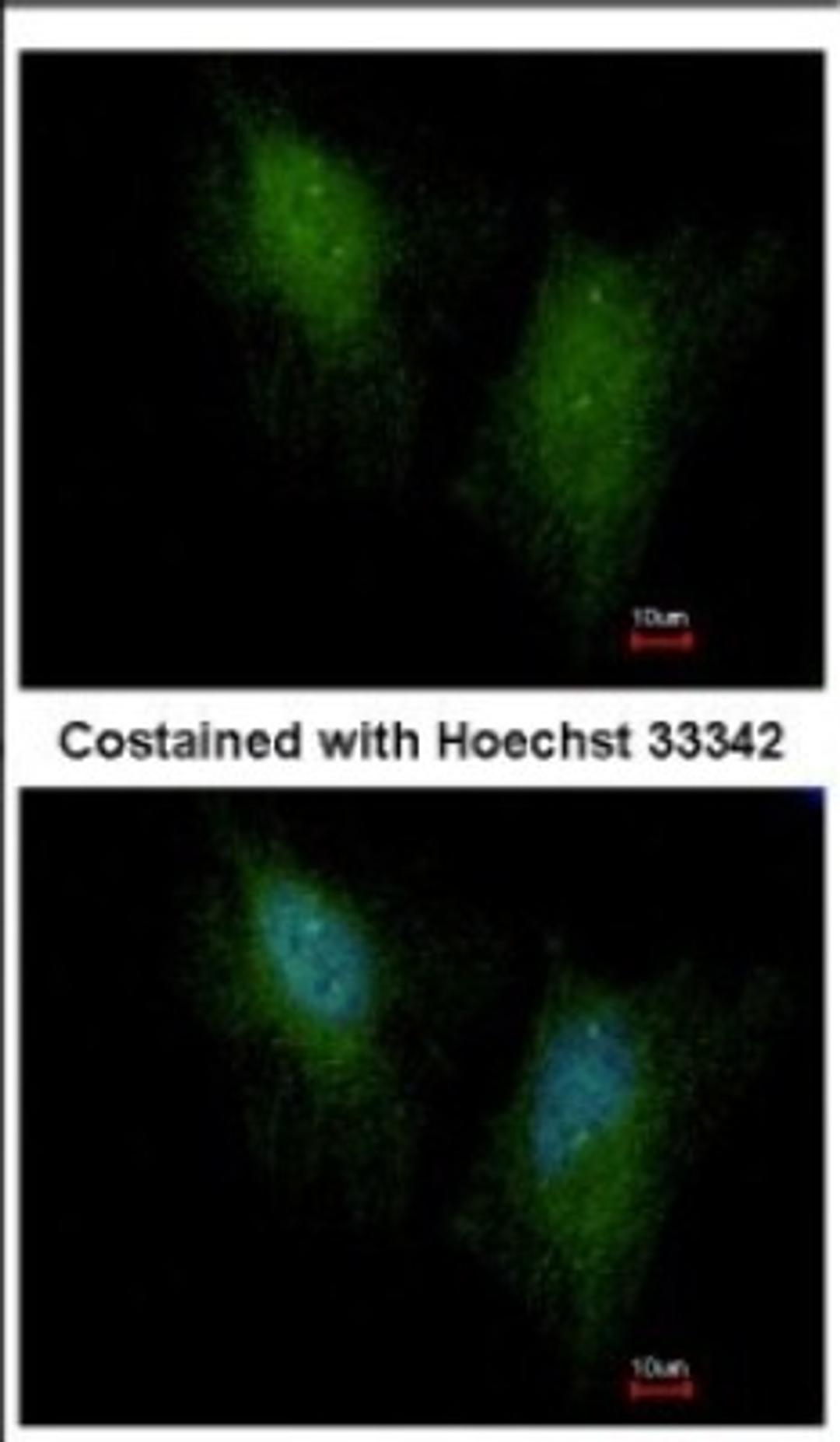 Immunocytochemistry/Immunofluorescence: SMAD5 Antibody [NBP2-20413] - Immunofluorescence analysis of paraformaldehyde-fixed HeLa, using antibody at 1:500 dilution.