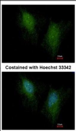 Immunocytochemistry/Immunofluorescence: SMAD5 Antibody [NBP2-20413] - Immunofluorescence analysis of paraformaldehyde-fixed HeLa, using antibody at 1:500 dilution.