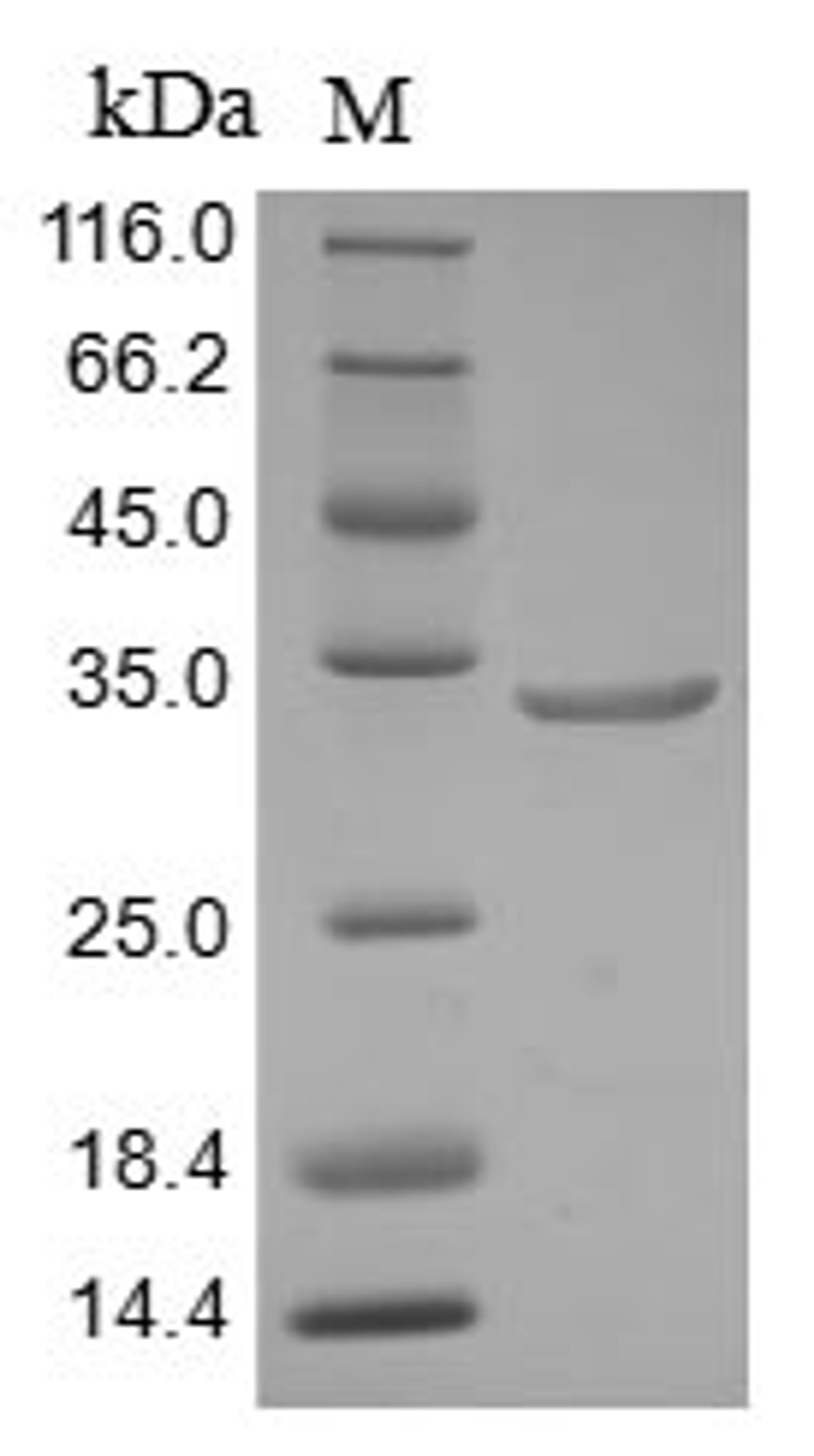 (Tris-Glycine gel) Discontinuous SDS-PAGE (reduced) with 5% enrichment gel and 15% separation gel.
