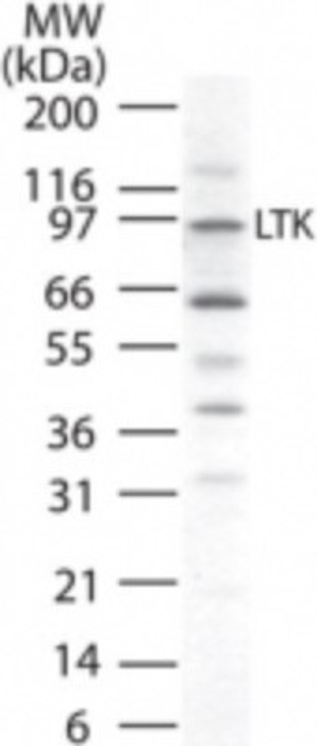 Western Blot: LTK Antibody [NB100-56425] - Analysis of LTK in human K562 cell lysate using this antibody at 1 ug/ml.