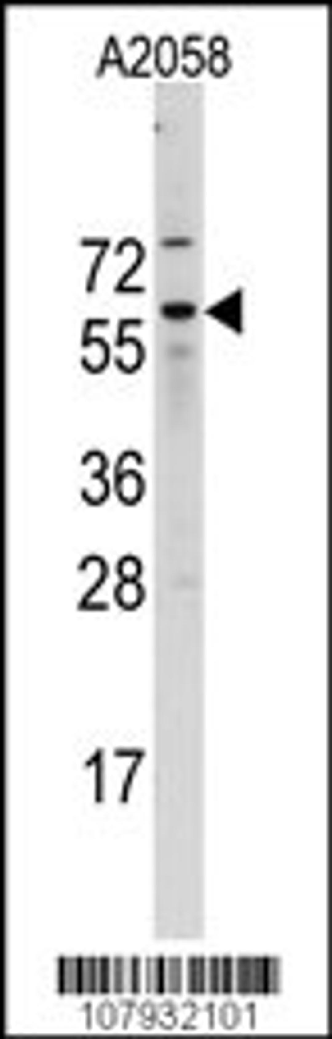 Western blot analysis of Cdc25B Antibody (A166) in A2058 cell line lysates (35ug/lane)