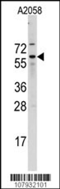 Western blot analysis of Cdc25B Antibody (A166) in A2058 cell line lysates (35ug/lane)