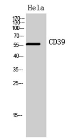 Western Blot analysis of Hela cells using CD39 antibody