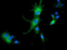 Immunocytochemistry/Immunofluorescence: ALDH1L1 Antibody (3D2) [NBP2-03143] - Staining of COS7 cells transiently transfected by pCMV6-ENTRY ALDH1L1.