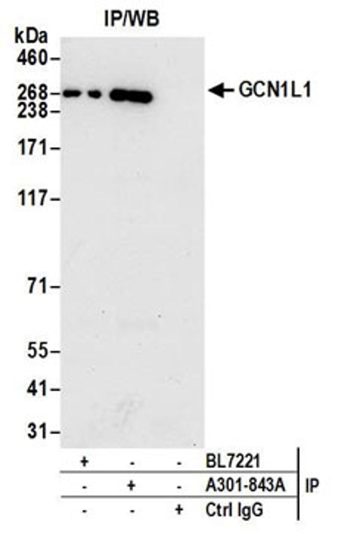 Detection of human GCN1L1 by western blot of immunoprecipitates.