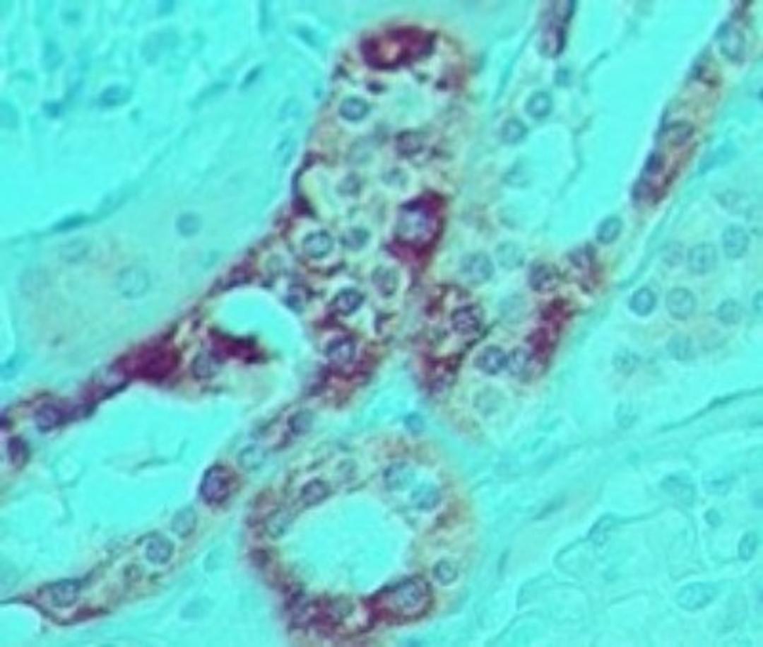 Immunohistochemistry: DDX58 Antibody (2M6F10) [NBP2-27109] - Analysis of RIG-I in formalin-fixed, paraffin-embedded human kidney using this antibody at 5 ug/ml.