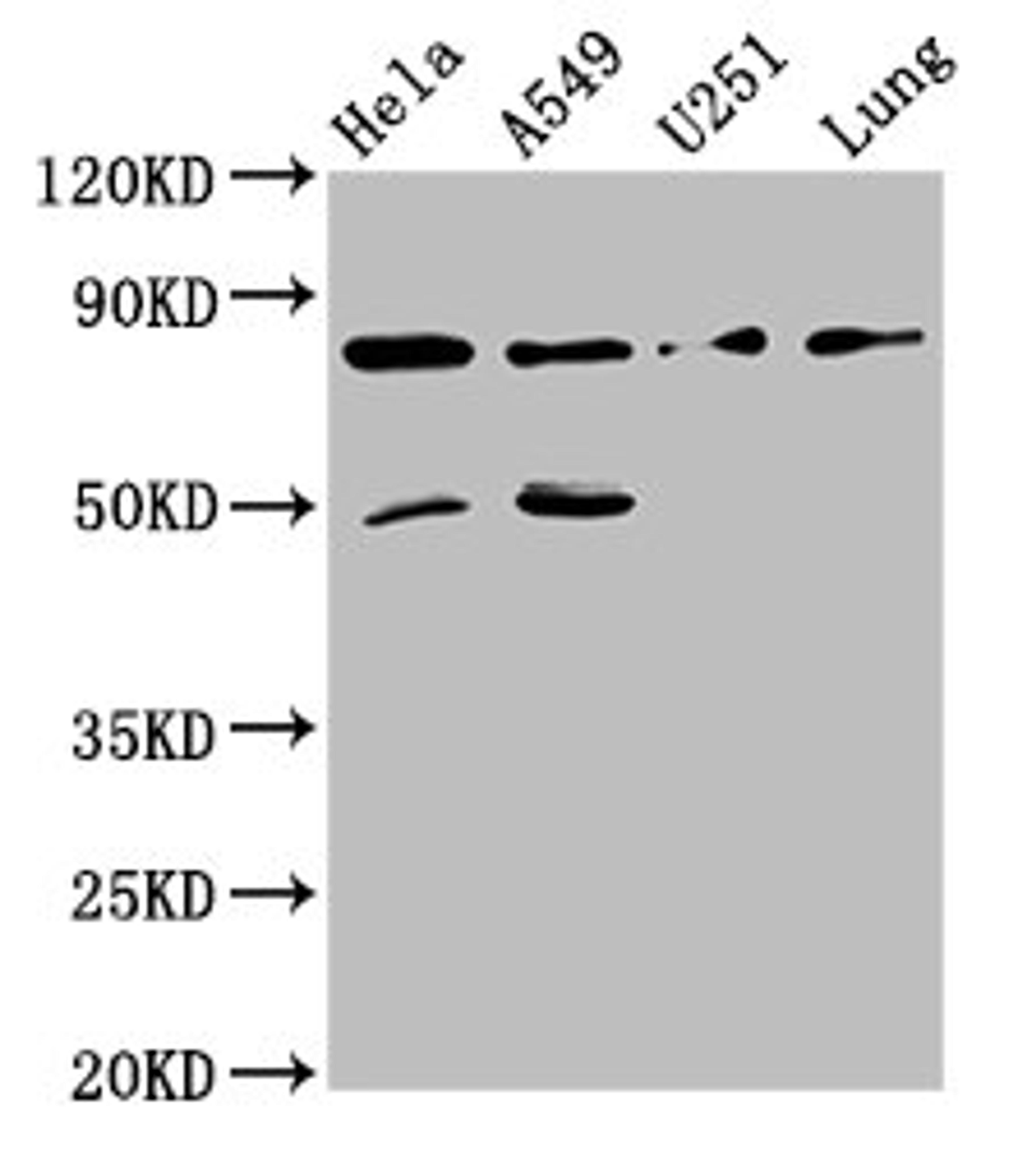 Western Blot. Positive WB detected in: Hela whole cell lysate, A549 whole cell lysate, U251 whole cell lysate, Mouse lung tissue. All lanes: Pcsk1 antibody at 8ug/ml. Secondary. Goat polyclonal to rabbit IgG at 1/50000 dilution. Predicted band size: 85 kDa. Observed band size: 85 kDa. 