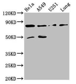 Western Blot. Positive WB detected in: Hela whole cell lysate, A549 whole cell lysate, U251 whole cell lysate, Mouse lung tissue. All lanes: Pcsk1 antibody at 8ug/ml. Secondary. Goat polyclonal to rabbit IgG at 1/50000 dilution. Predicted band size: 85 kDa. Observed band size: 85 kDa.