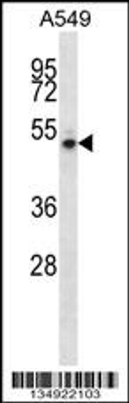 Western blot analysis in A549 cell line lysates (35ug/lane).