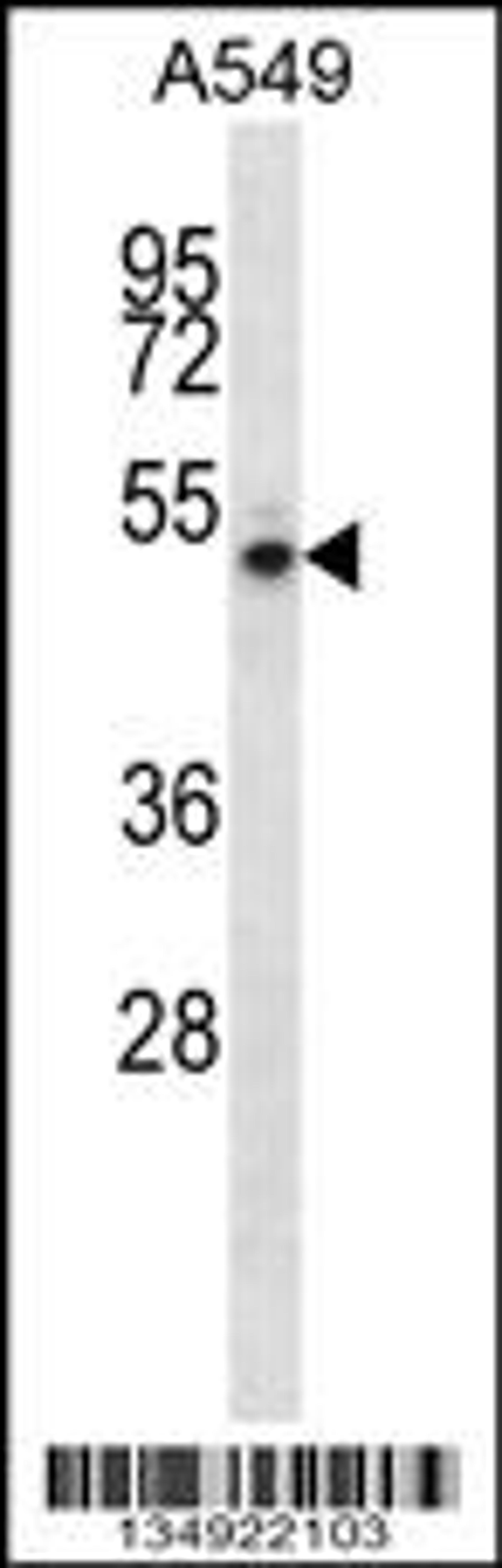 Western blot analysis in A549 cell line lysates (35ug/lane).