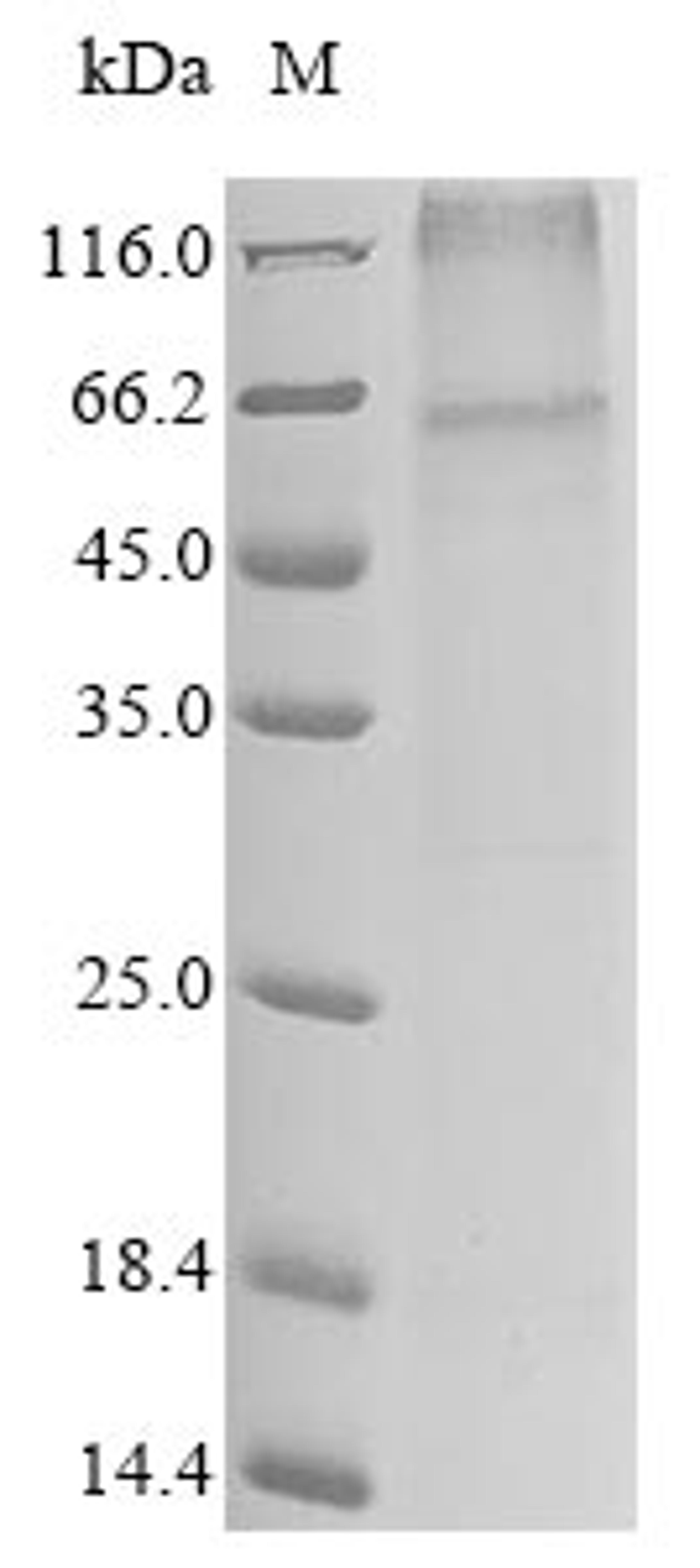 (Tris-Glycine gel) Discontinuous SDS-PAGE (reduced) with 5% enrichment gel and 15% separation gel.