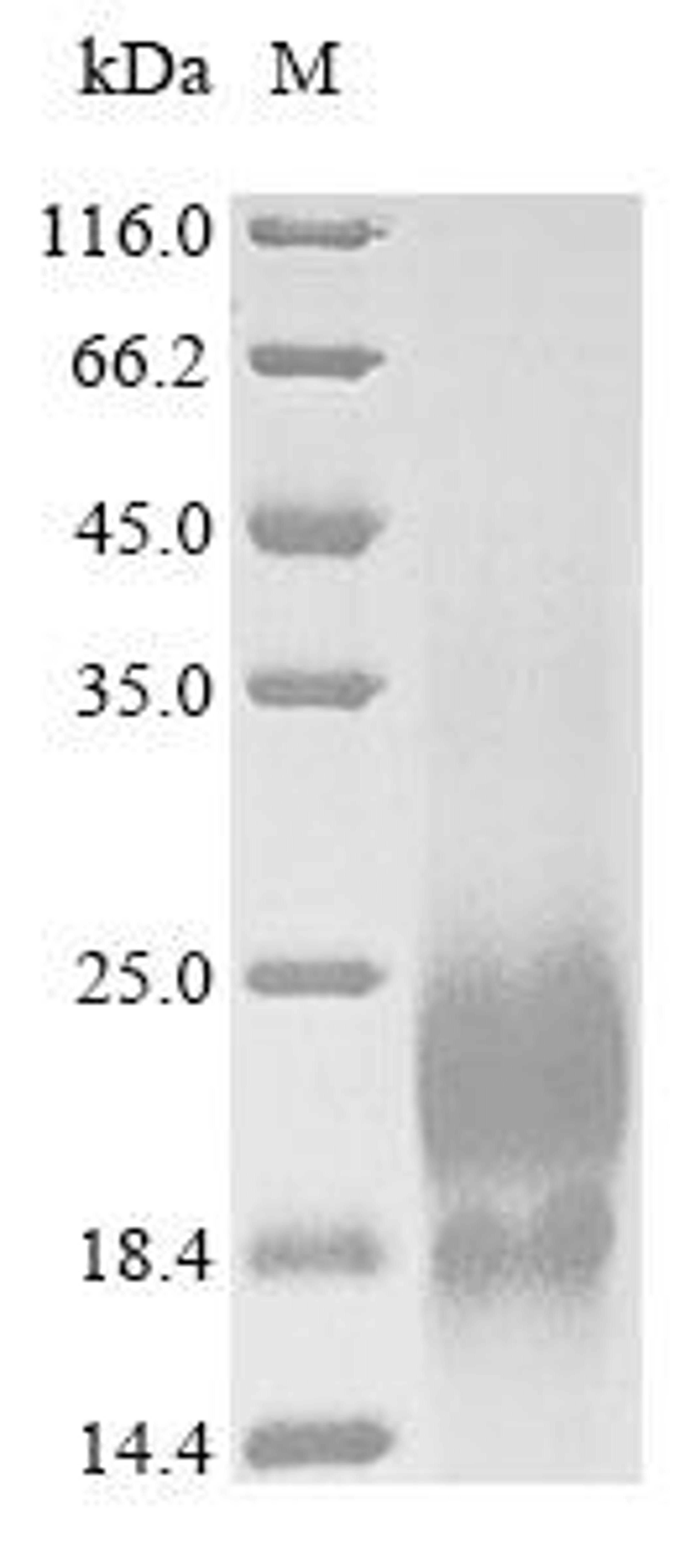 (Tris-Glycine gel) Discontinuous SDS-PAGE (reduced) with 5% enrichment gel and 15% separation gel.
