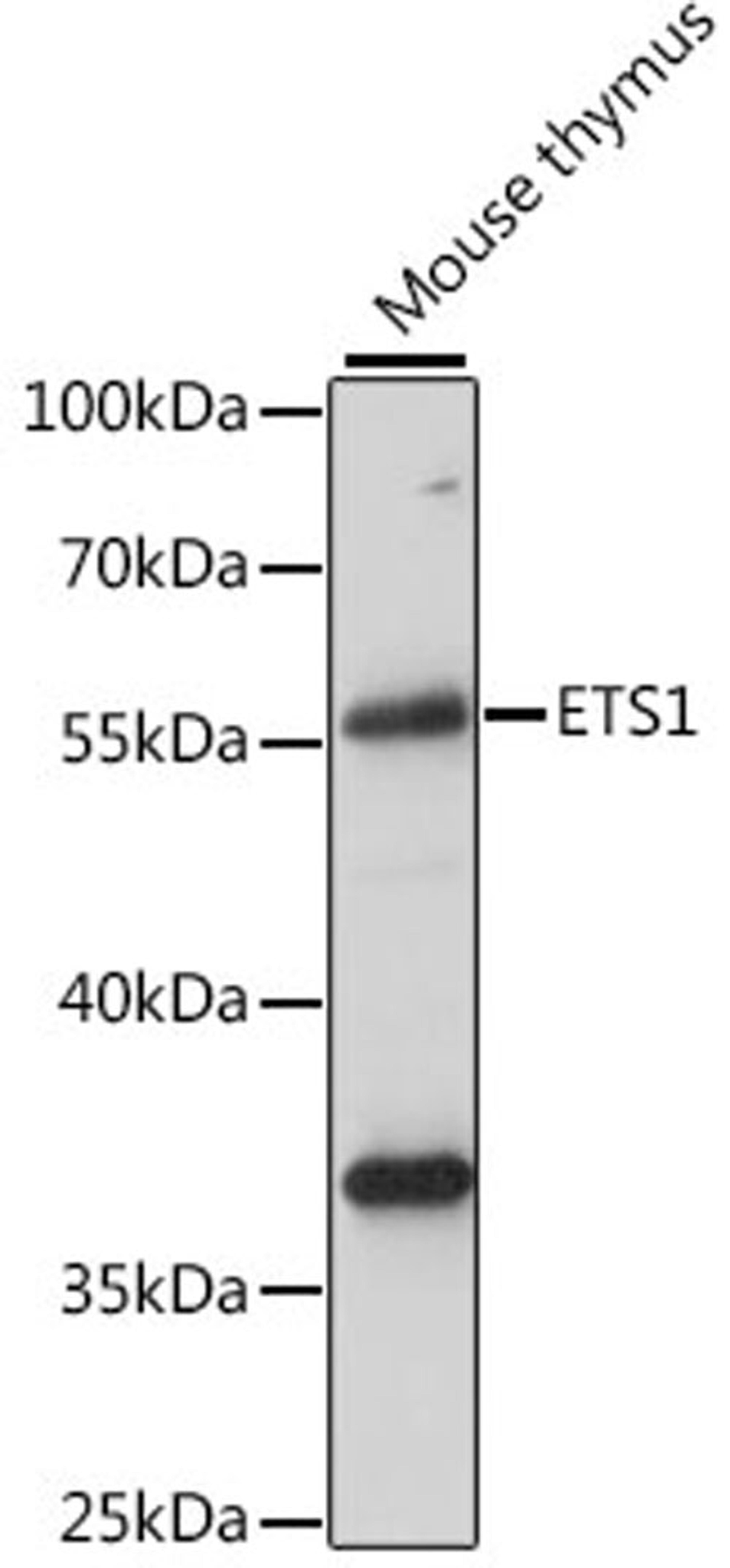 Western blot - ETS1 antibody (A15666)