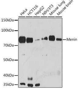 Western blot - Menin Rabbit mAb (A3395)