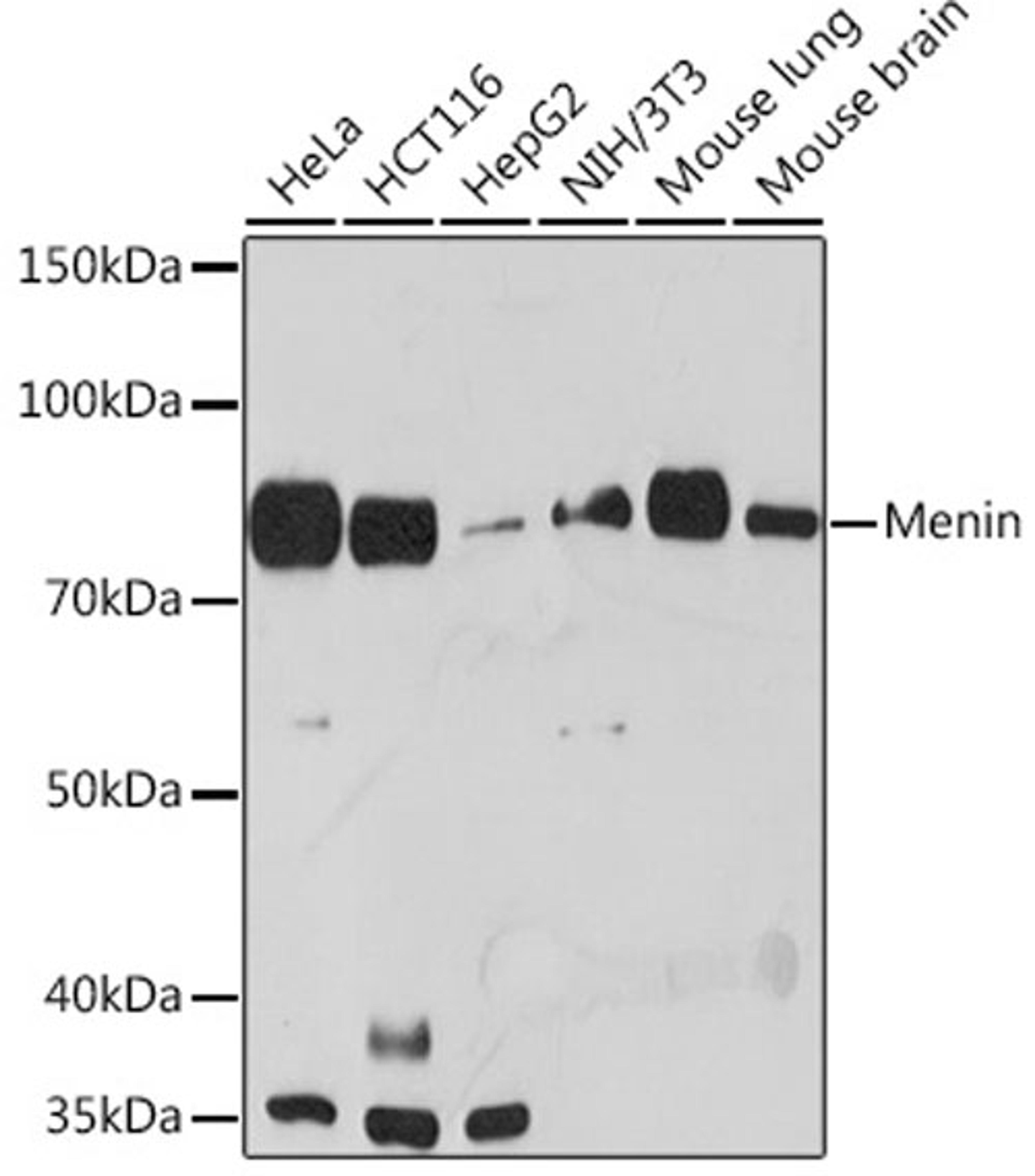 Western blot - Menin Rabbit mAb (A3395)
