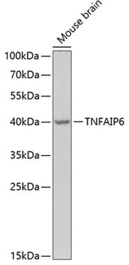 Western blot - TNFAIP6 Antibody (A6419)