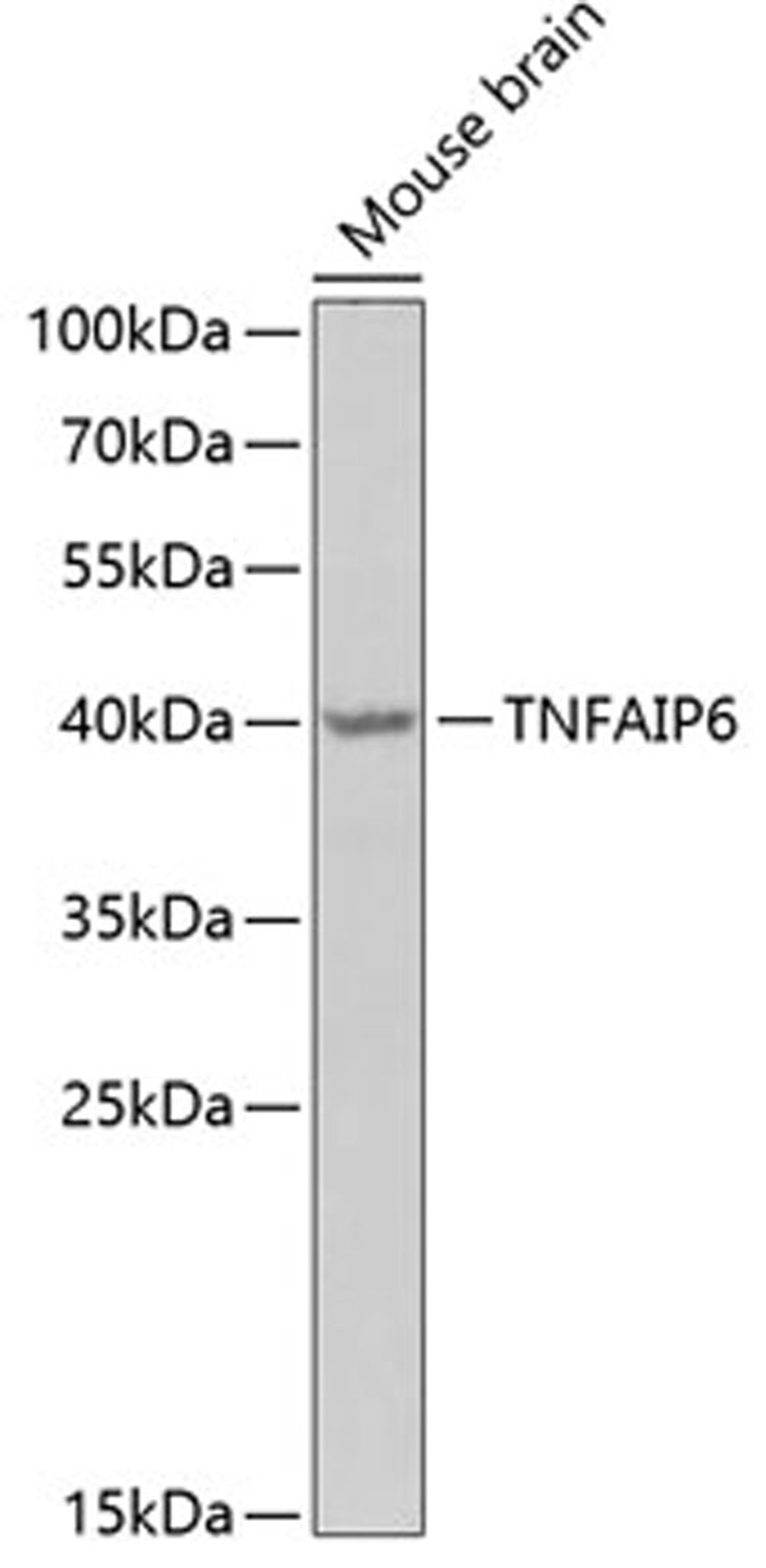 Western blot - TNFAIP6 Antibody (A6419)