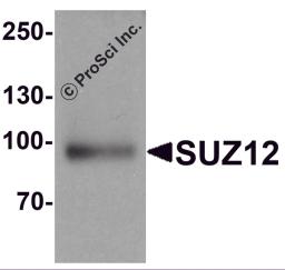 Western blot analysis of SUZ12 in human liver tissue lysate with SUZ12 antibody at 1 &#956;g/ml.