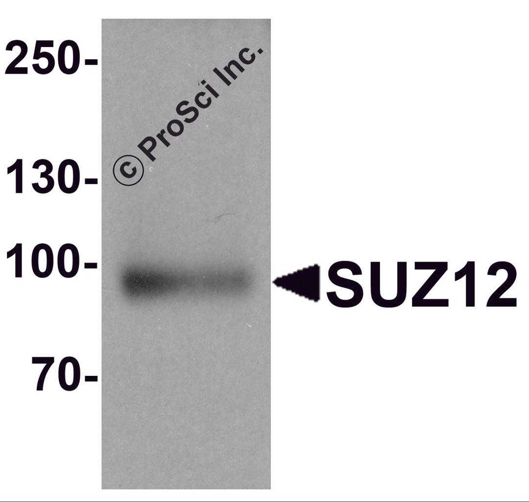 Western blot analysis of SUZ12 in human liver tissue lysate with SUZ12 antibody at 1 μg/ml.