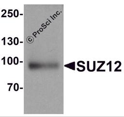 Western blot analysis of SUZ12 in human liver tissue lysate with SUZ12 antibody at 1 μg/ml.