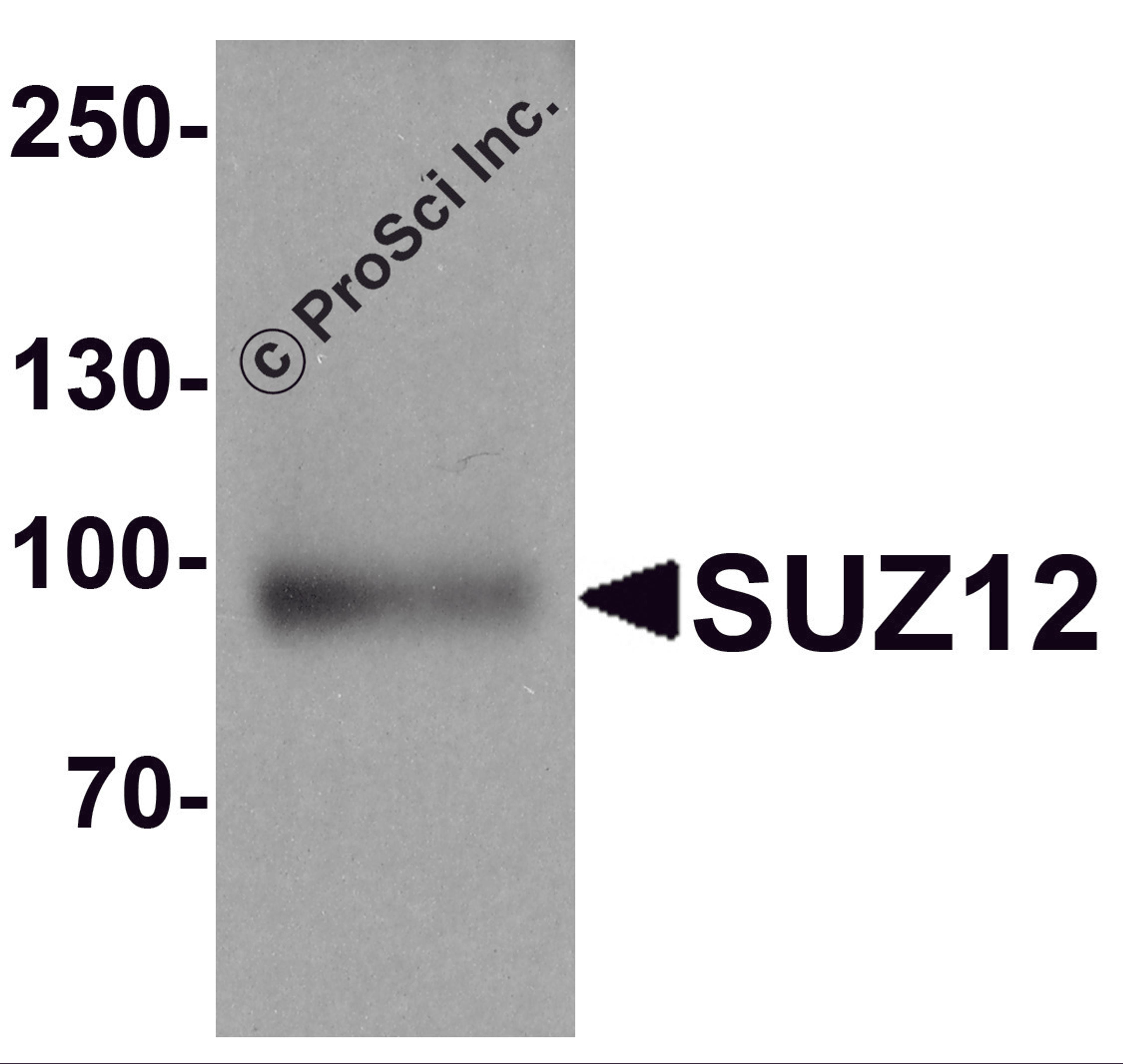 Western blot analysis of SUZ12 in human liver tissue lysate with SUZ12 antibody at 1 μg/ml.