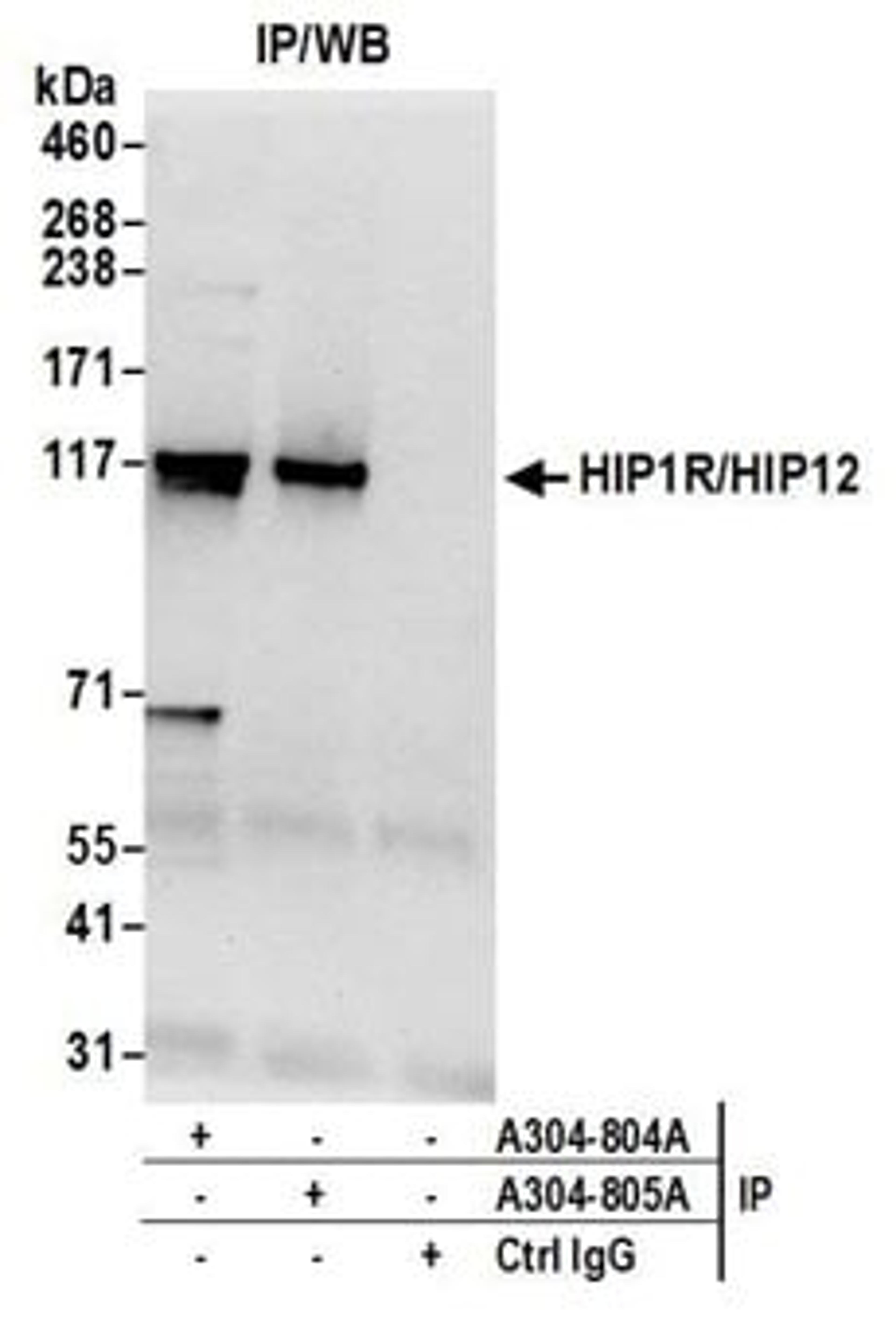 Detection of human HIP1R/HIP12 by western blot of immunoprecipitates.