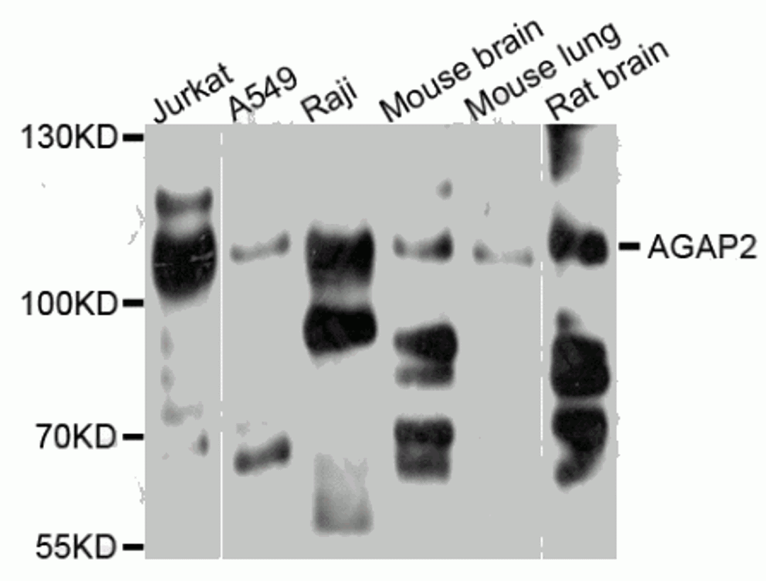 Western blot analysis of extracts of various cell lines, using AGAP2 antibody