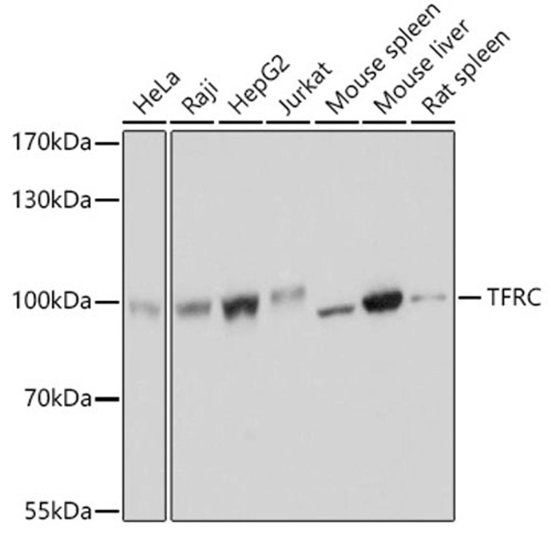 Western blot - TFRC antibody (A5865)