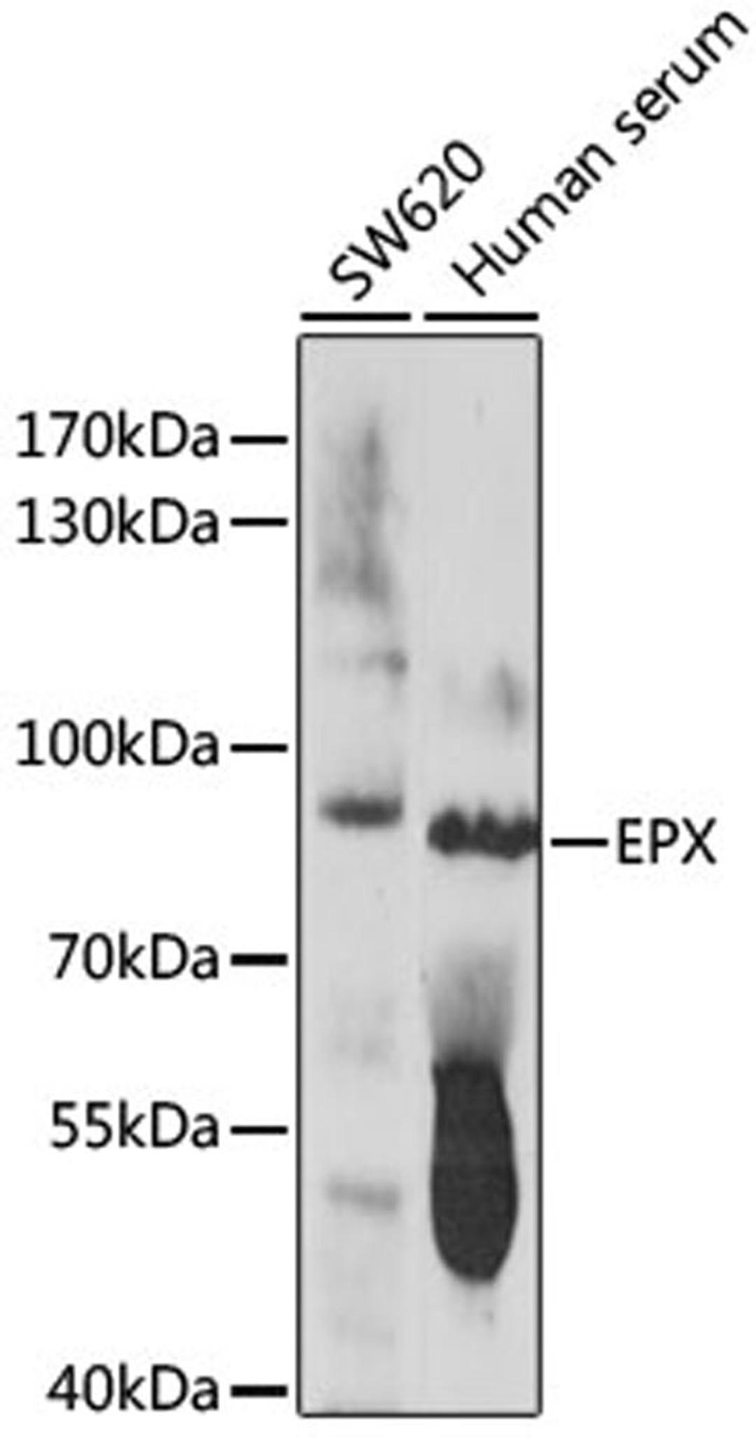 Western blot - EPX antibody (A16450)