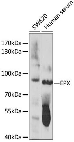 Western blot - EPX antibody (A16450)