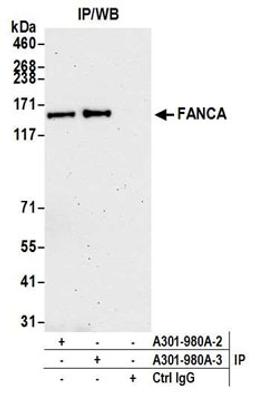 Detection of human FANCA by western blot of immunoprecipitates.