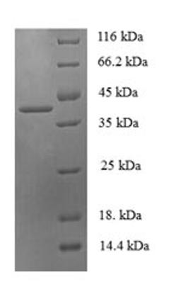 (Tris-Glycine gel) Discontinuous SDS-PAGE (reduced) with 5% enrichment gel and 15% separation gel.