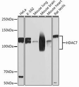 Western blot - HDAC7 Rabbit mAb (A13008)