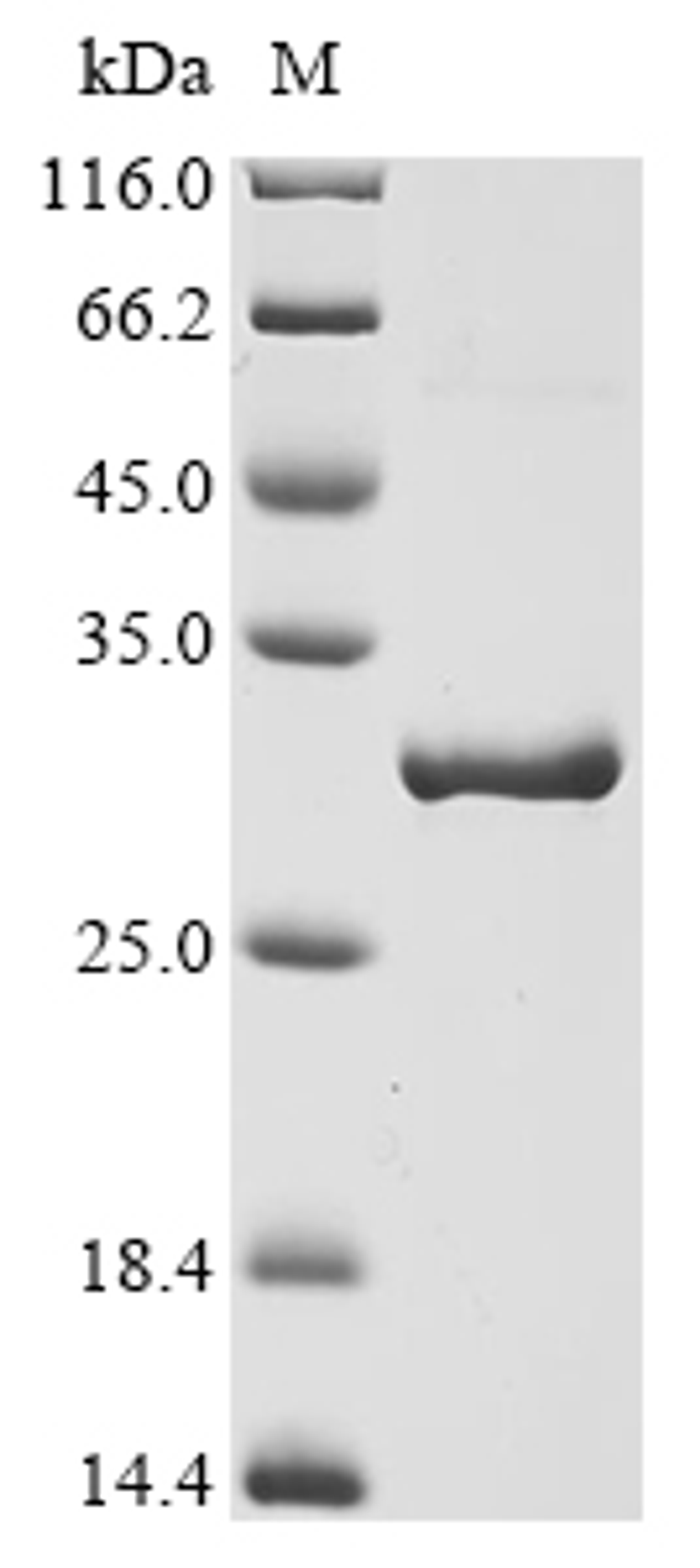 (Tris-Glycine gel) Discontinuous SDS-PAGE (reduced) with 5% enrichment gel and 15% separation gel.