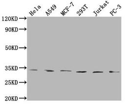 Western Blot. Positive WB detected in: Hela whole cell lysate, A549 whole cell lysate, MCF-7 whole cell lysate, 293T whole cell lysate, Jurkat whole cell lysate, PC-3 whole cell lysate. All lanes: ZNF346 antibody at 1:1000. Secondary. Goat polyclonal to rabbit IgG at 1/50000 dilution. Predicted band size: 33, 36, 30 kDa. Observed band size: 33 kDa.